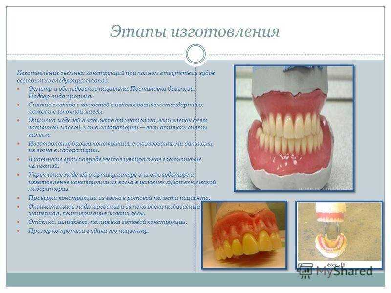 Протезирование зубов: современные методы