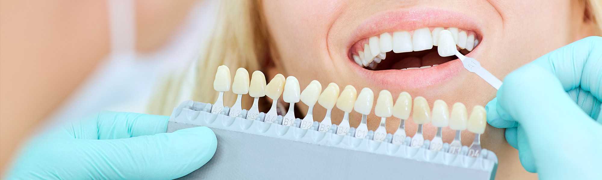 Методы протезирования зубов: цены и виды протезов, способы протезирования зубов