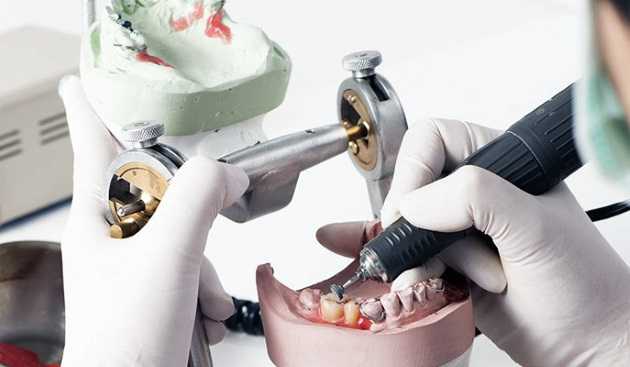 Протезирование зубов. виды зубных протезов: их различия и преимущества